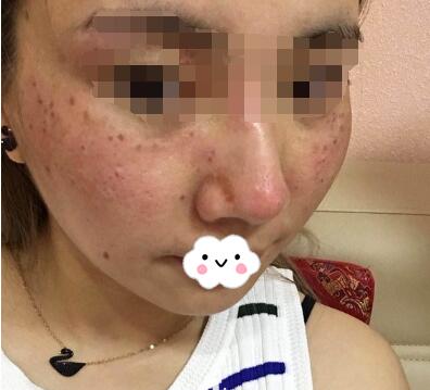 Ƥ�뼤����ȸ��