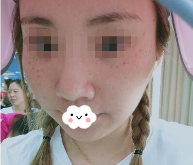 Ƥ�뼤����ȸ��