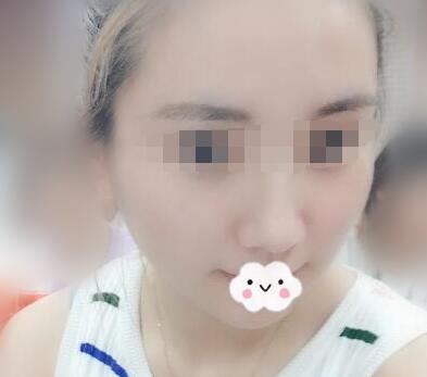 Ƥ�뼤����ȸ��