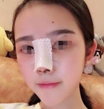 ����ǽ������������Ѷ��ǱȽϴ��