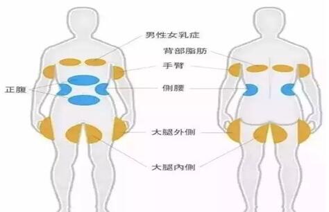 �����䶳��֬ ���ž����ݵĺڿƼ�