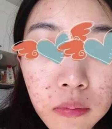 �����沿��̺ۺ����沿�İ̺���ȫ��ʧ��