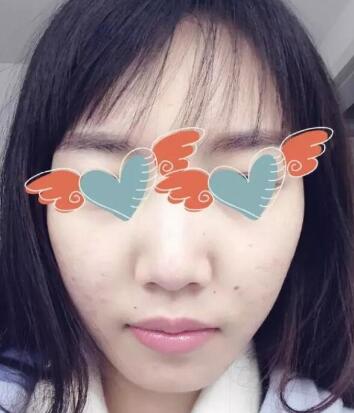 �����沿��̺ۺ����沿�İ̺���ȫ��ʧ��