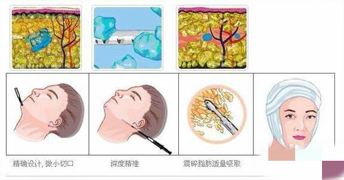 �����沿��֬�ٿ�