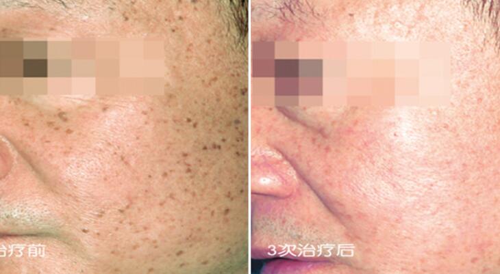 M22����֮������������ٿ�