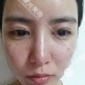 ����Ƥ�룬�������ڿ���˯������