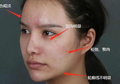 �����䲽��25��֮�����Ǹ���ô�Կ�˥��