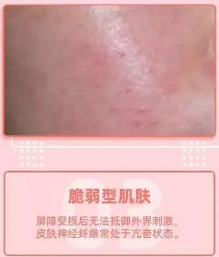 �����ξ�Ʒ���ܶ�Ů������Ƥ�����ⶼ����Ϊ���Ĵ���