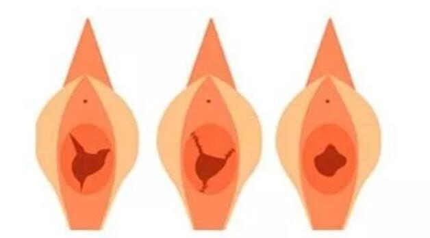 ŮĤ޸ܱܲ⣬ǵµİܣ ŮԵĽ