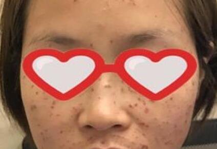 ������߽�����һ�ε����ƣ���ȫ���ָ���