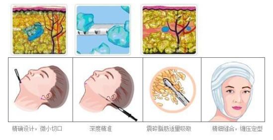 ����̫�ʣ�ҧ���г�����˵�������ܸ㶨