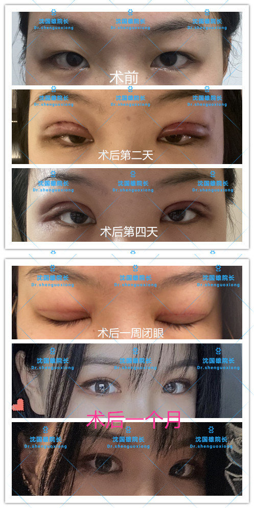 �ó��۲��޸�����ҽ�������2020��3���°�Ѯ��4���ϰ�Ѯ����ʱ��