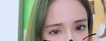 ˫��Ƥ�����ĳɹ����������������޼ɵ����ഺ�������õ��Լ�