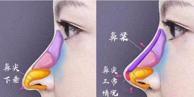 ��ͷ��������������޸�