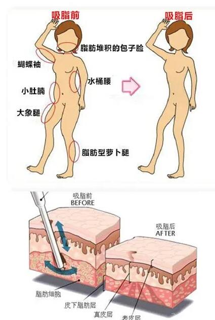 ������ʲô�ѵ��һ����֬�����Ϳ��Ը㶨