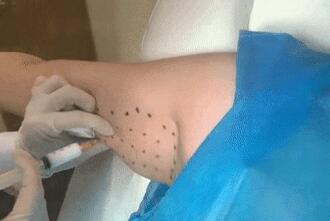���������ʡ�������6�ڴΣ�ԭ��ֱ������