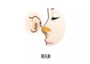 �Ǽⲻ�ÿ�������ʲô����