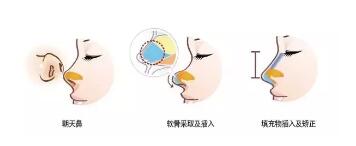 �Ǽⲻ�ÿ�������ʲô����