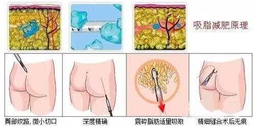 �����ǣ�����Ҫ�Ĳ��������������µ������������ඣ�