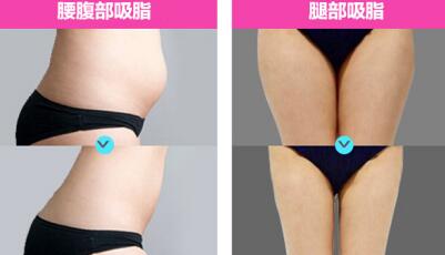 ��ҽ�����ա�������֬������Ҳ�����ֵ��뷨����ȡ