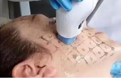 ������С�ٶ������꼪��ʵ���ƽ��۲����塱��
