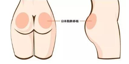 ����Ѫ�����ŵ�������Ů����ɱ�����������̫����