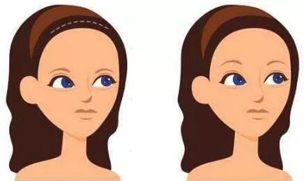 看一位患者独白【发际线拯救计划】