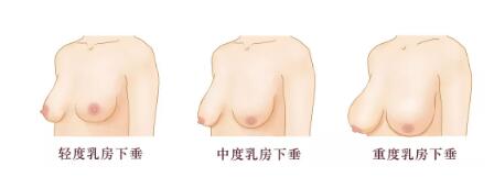 Ů����У�Ϊʲô�鷿���´�