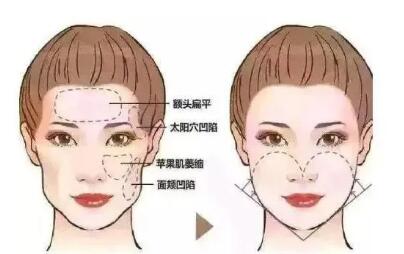 ��ҽ�����ա��沿��䣬֬���������ᡢ��ԭ���׶���ʲô����