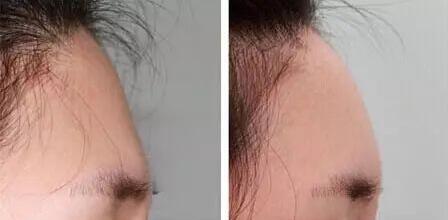 ����90���Ѿ����ϳ���֢��ȴ����֪��Ϊʲô���ϣ�