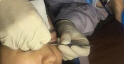 ˫��Ƥ��������1���� ��ӵ�����������ഺ