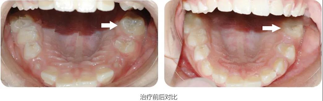 �Ͼ��������������θ�ȫ��������������࣬�ҳ���֪��֪ʶ