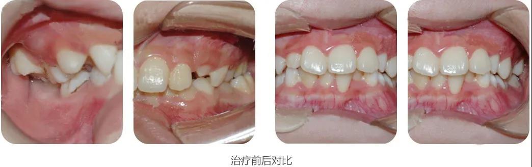 �Ͼ��������������θ�ȫ��������������࣬�ҳ���֪��֪ʶ