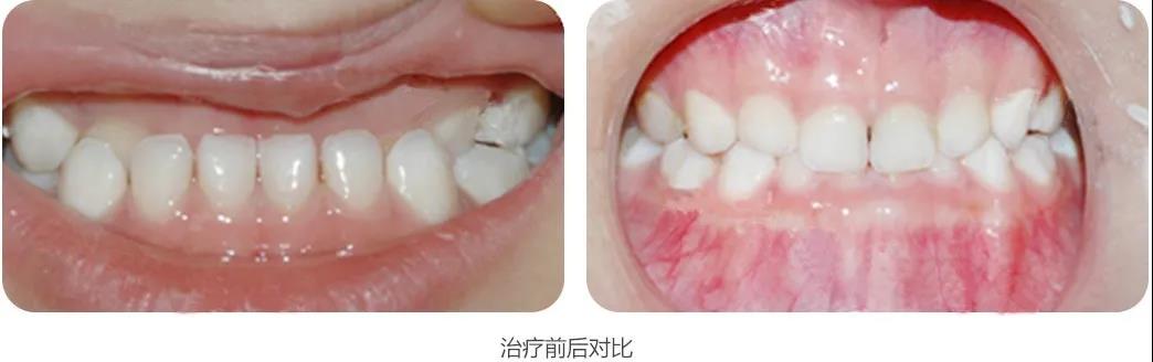 �Ͼ��������������θ�ȫ��������������࣬�ҳ���֪��֪ʶ