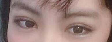 ˫��Ƥ����45�죬������а�Ĵ��۾�