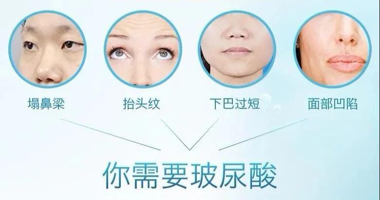 ����������̫������ô�죿�ò����ᱣ�ֳ��õķ���