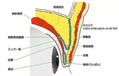 如何断定自己长眼袋?眼袋怎么去除效果好?