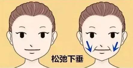 【整形精品】脸越来越大,是不是长胖了,不一定,还可能是衰老