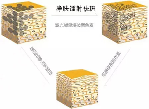 ���令�� ��߾�����ô�ļ�