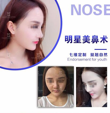 հǡ