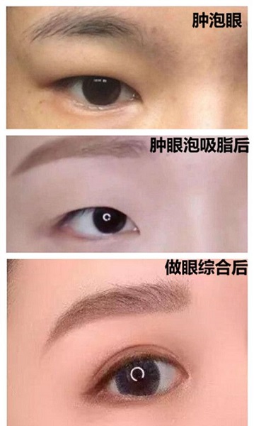 ����Ƥֻ��֬����˫��Ƥ�����𣿿�һ��Ч����֪����
