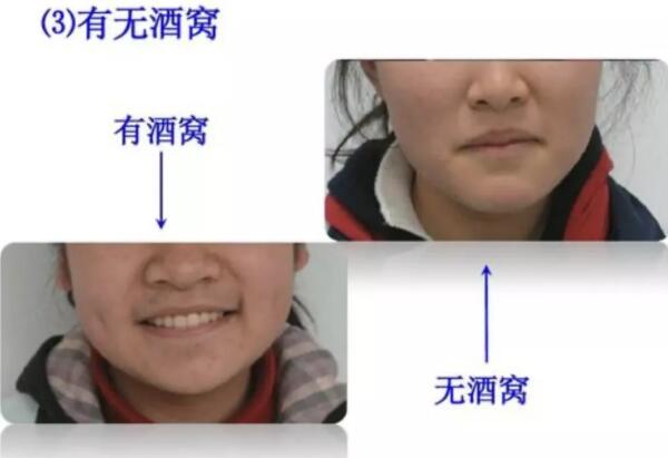 ѵͳ췽