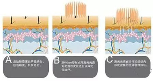 ����Co2�������� ����̼�Ƥ�����