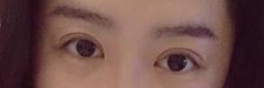 弧度弯弯的双眼皮,整个眼睛看起来都特别的迷人