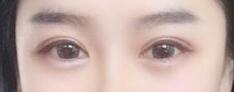弧度弯弯的双眼皮,整个眼睛看起来都特别的迷人