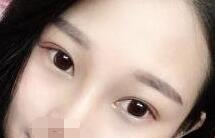 ˫��Ƥ��������һ���µľ��Ļ������۾�Խ��Խ��Ȼ