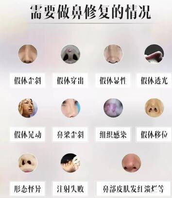 Ϊô����4�α��޸��������ָܻ������������