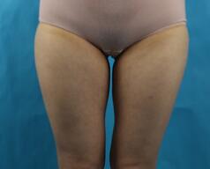 ������֬�����ʮ�죬����ǰ����һȦ