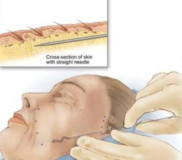 那些一直不老的精致girl都有什么隐藏技能