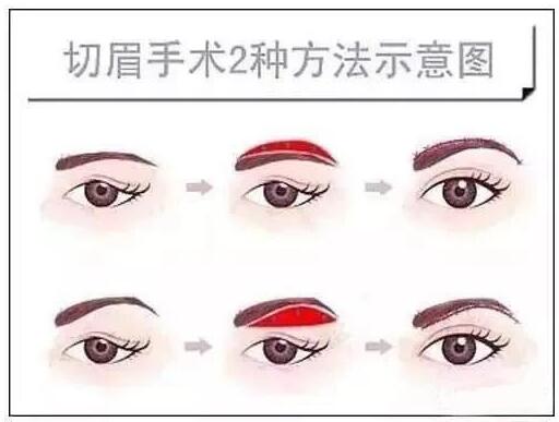 ��ü����ü���в�ͬ����ü�����ְ취������